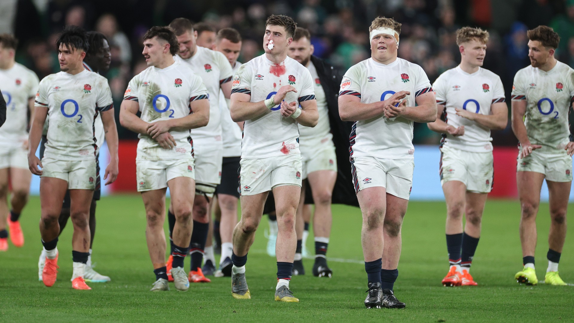 Borthwick sees England improvements